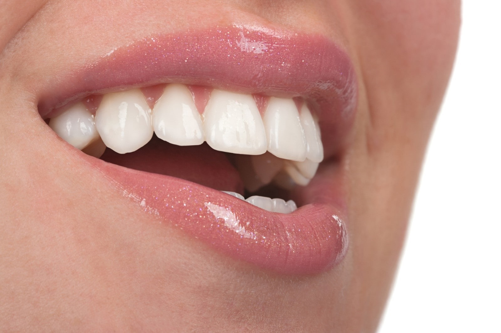 پیامدهای عدم رعایت بهداشت دهان و دندان پس از لمینت