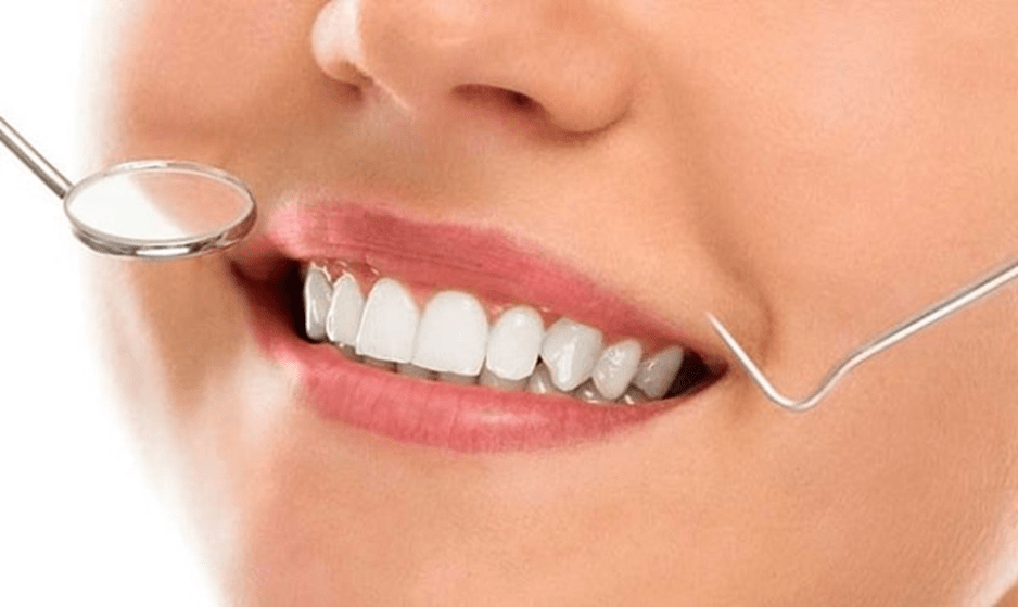 نکات و اصول مهم در اصلاح طرح لبخند با ایمپلنت دندان جلو