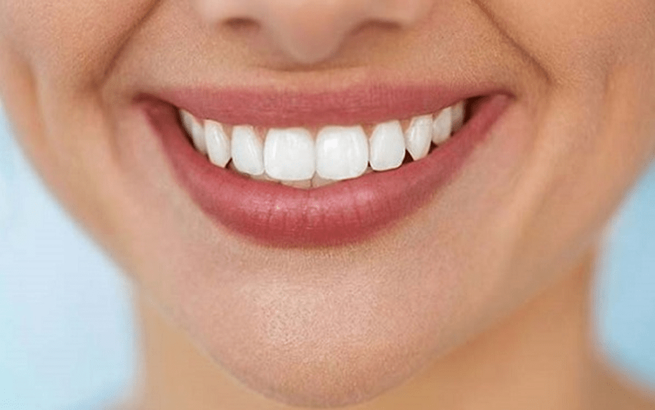 مهم ترین مراقبت ‌های بعد از اصلاح طرح لبخند با ایمپلنت دندان جلو