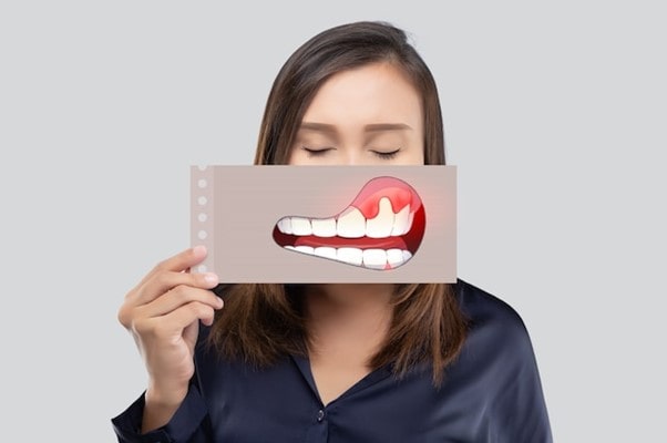 آیا بلیچینگ دندان در همه افراد دردآور است؟ 
