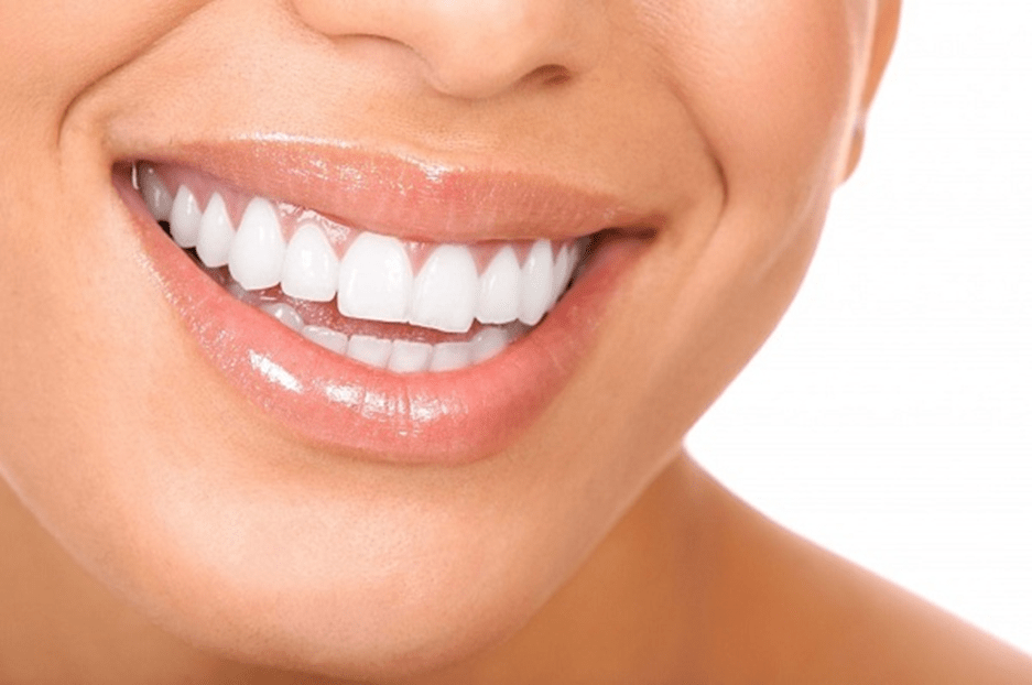 کاربرد ایمپلنت دندان جلو در اصلاح طرح لبخند