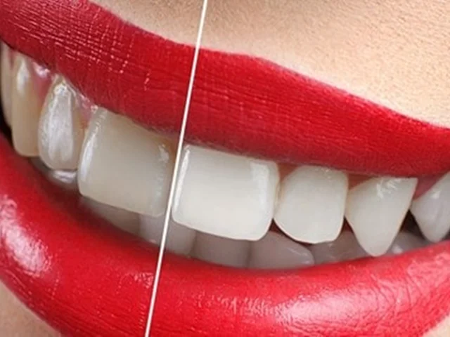 مزایای بلیچینگ دندان برای خلق لبخندی درخشان