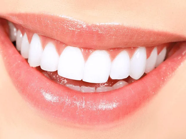 ایمپلنت دندان جلو برای اصلاح طرح لبخند