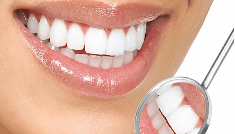 چگونه ماندگاری و طول عمر کامپوزیت دندان را افزایش دهیم؟